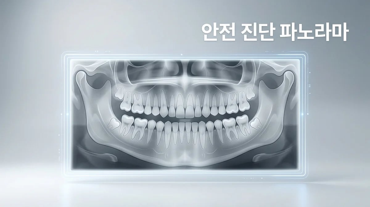 임플란트 파노라마 엑스레이, 안전하고 정확한 진단 필수 이유 4가지