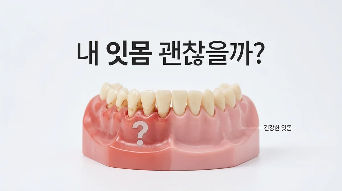 잇몸 질환의 종류와 단계별 치과 치료: 구강 건강 관리 가이드