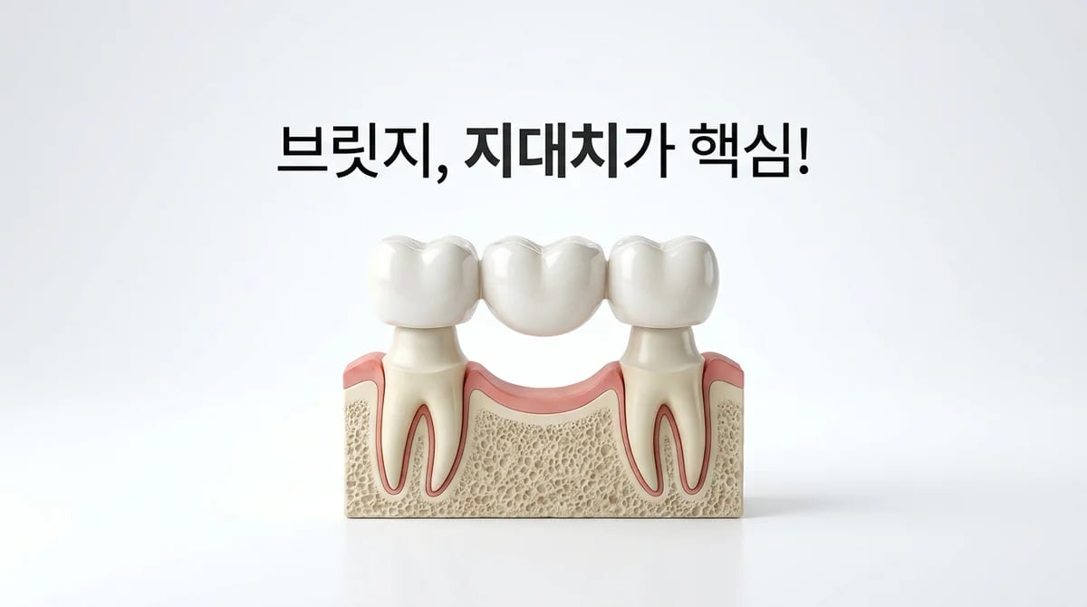 잇몸뼈 부족 시 치아 브릿지 가능성: 핵심 고려사항과 판단 기준 3가지