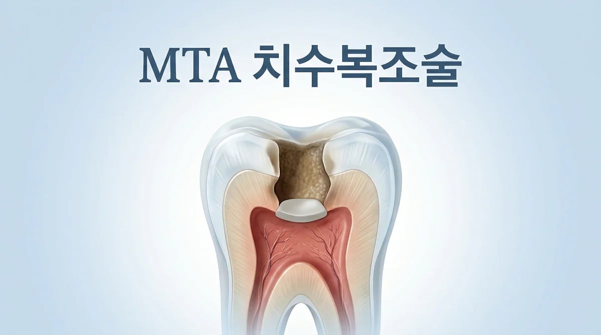MTA 치수복조술: 손상된 치수를 보호하고 회복을 유도하는 5가지 핵심 정보