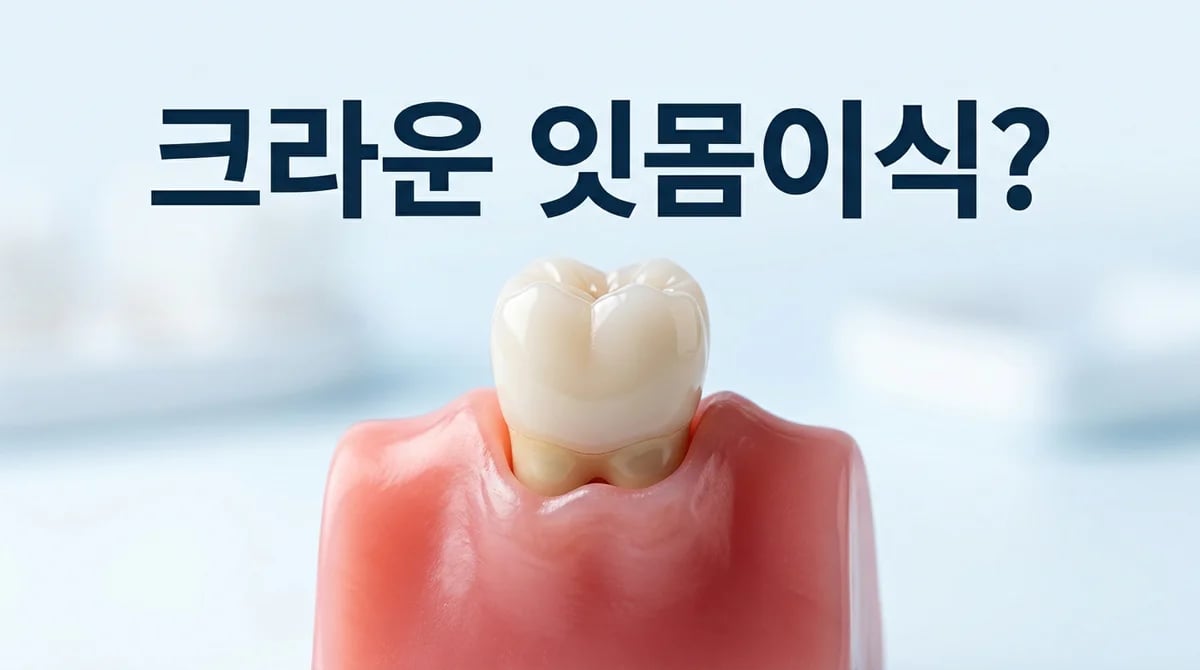 크라운 치아 잇몸 퇴축: 잇몸이식 가능성과 치료 접근법