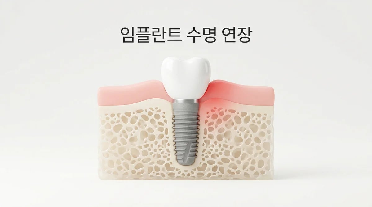 임플란트 주위염: 발생 원인과 효과적인 예방 및 관리 전략