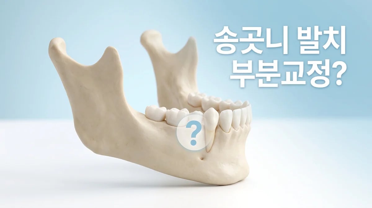 송곳니 발치 후 부분교정: 신중한 결정을 위한 핵심 정보
