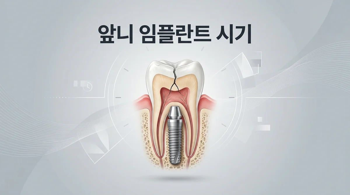 앞니 파절 임플란트, 언제 해야 할까요? 치료 시기 결정 기준 3가지