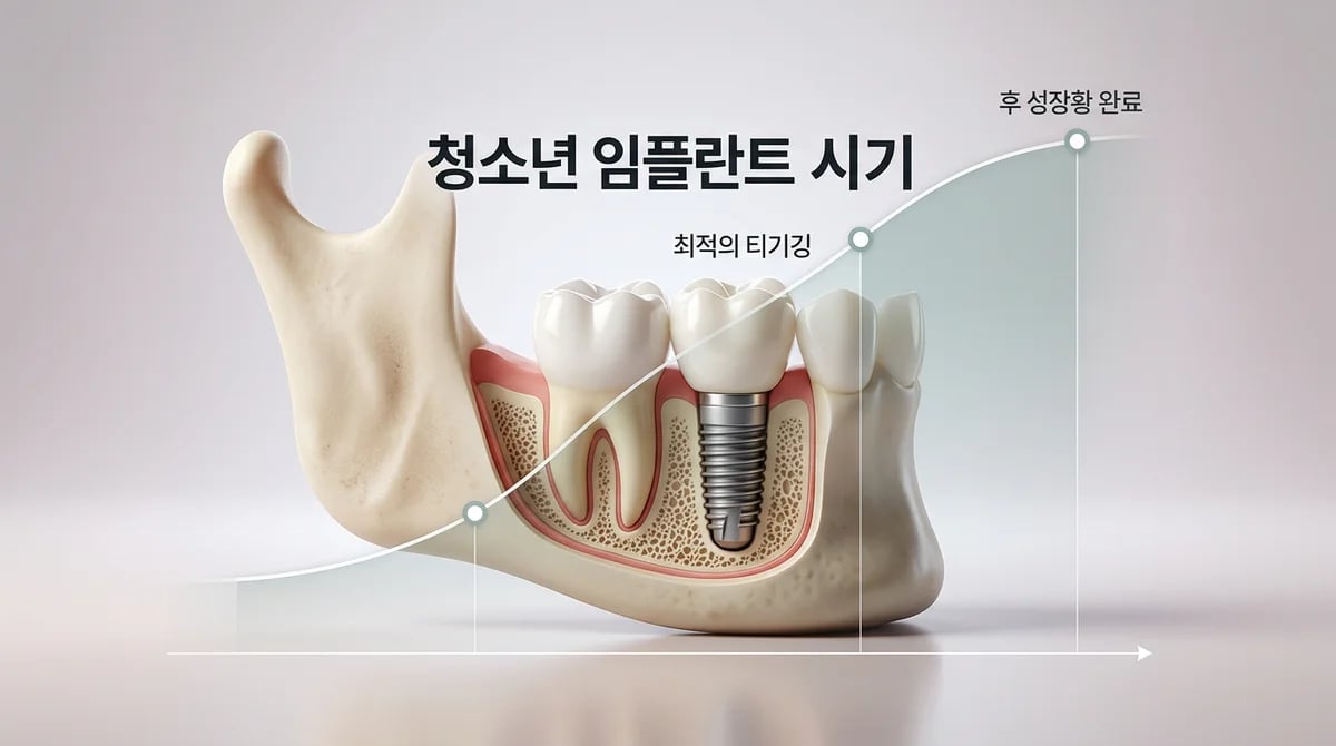 18세 청소년 어금니 임플란트, 악골 성장 완료 판단과 관리 전략