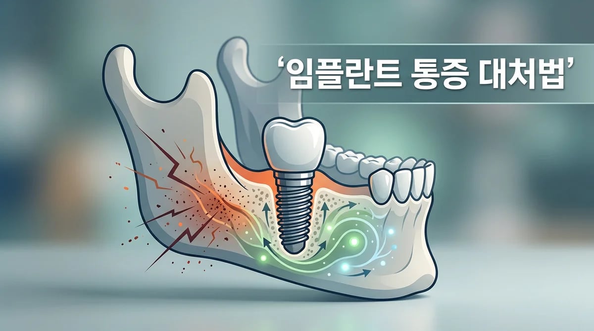 임플란트 시술 후 통증, 왜 생길까? 시기별 대처법 완벽 가이드