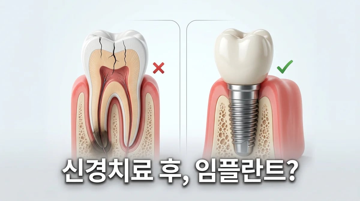 신경치료 후 지속되는 통증: 재치료와 임플란트 고려 가이드