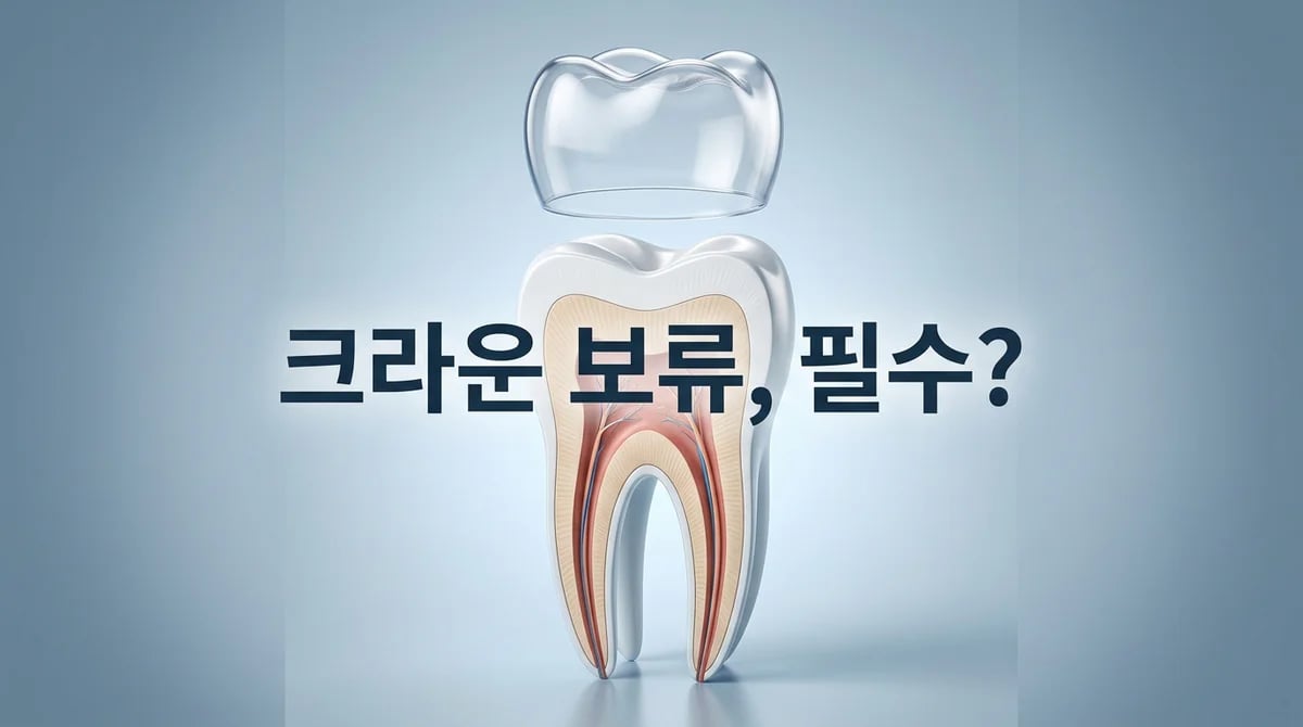 신경치료 후 크라운 보류, 왜 중요할까요? 치아 건강을 위한 3가지 이유