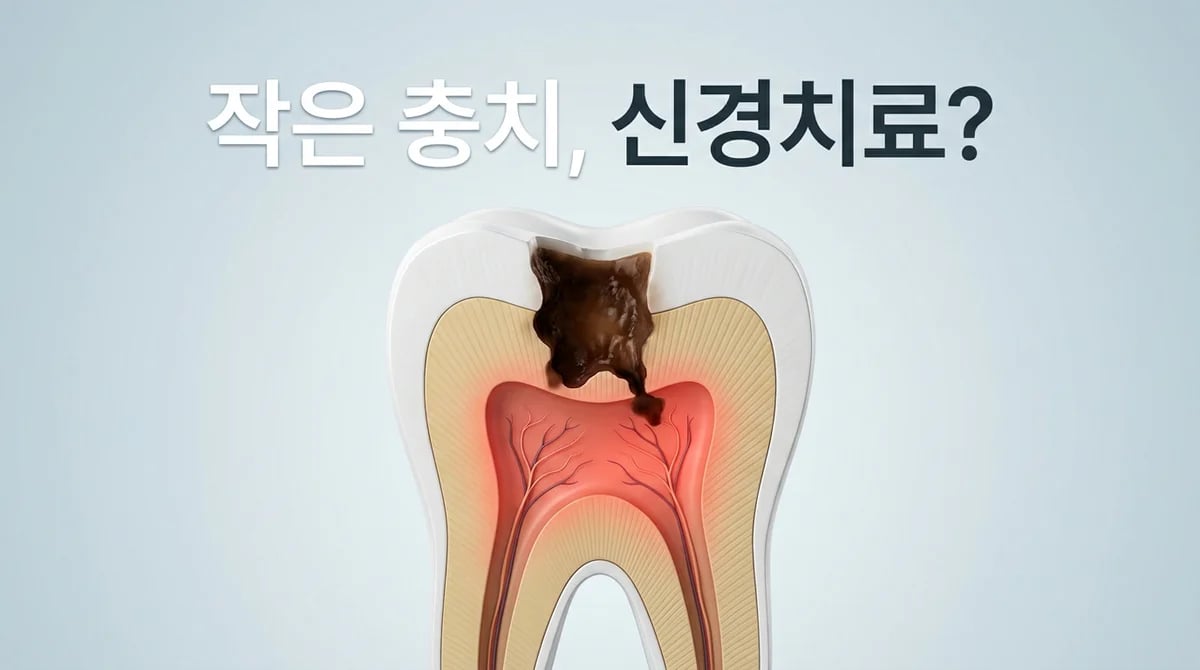 겉보기엔 작은 충치, 왜 신경치료가 필요할까요? 원인과 진단 중요성