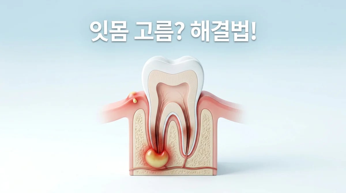 신경치료 후 잇몸 고름: 원인 분석 및 대처법 상세 안내