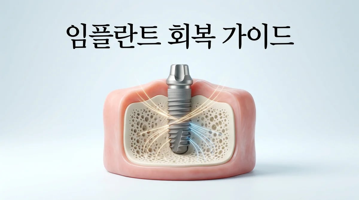 임플란트 식립 후 회복 기간과 관리: 성공을 위한 단계별 가이드