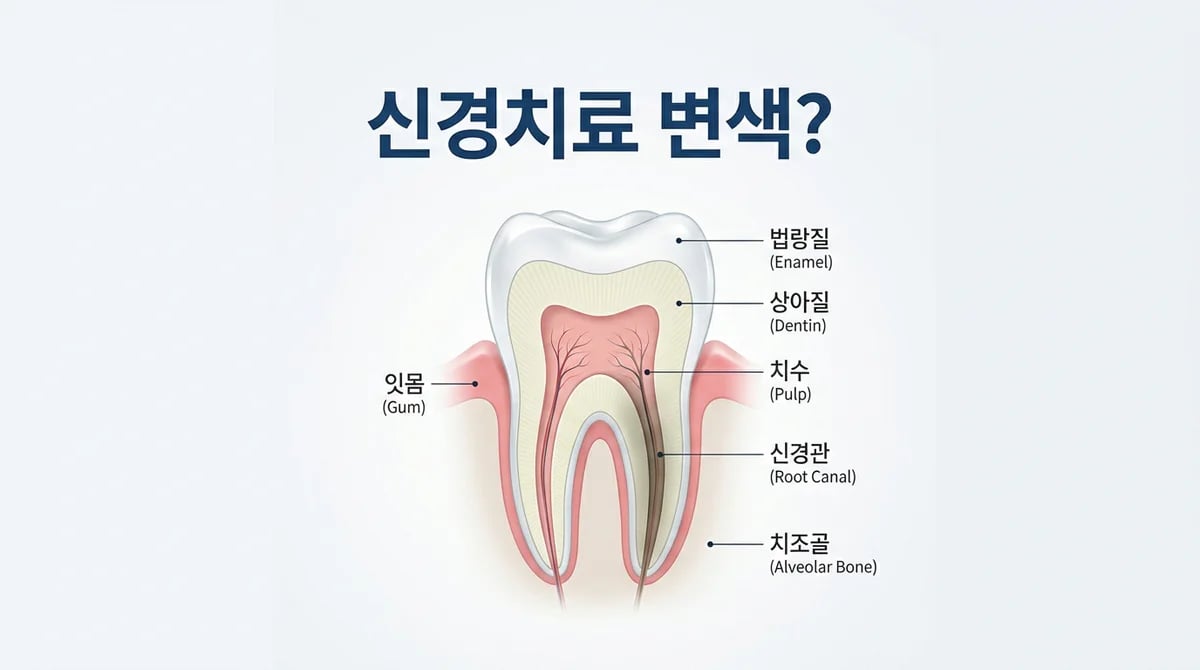 신경치료 후 치아 변색, 원인부터 예방 및 개선 방법까지 완벽 가이드