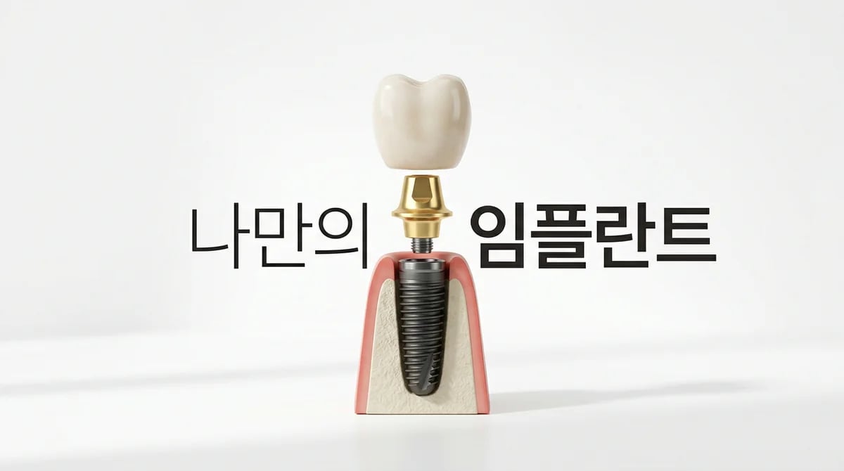 나에게 맞는 임플란트 종류 선택: 핵심 기준과 가이드