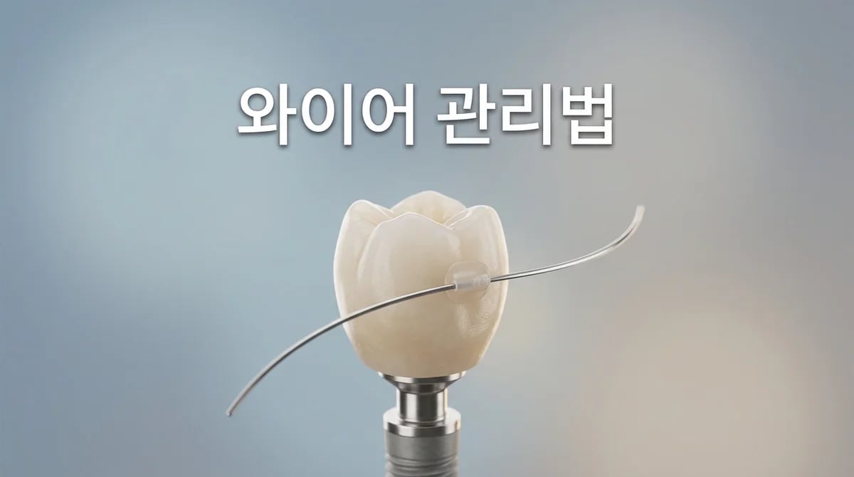 임플란트 임시치아 와이어: 성공적 골유착 위한 3가지 핵심 역할과 관리법