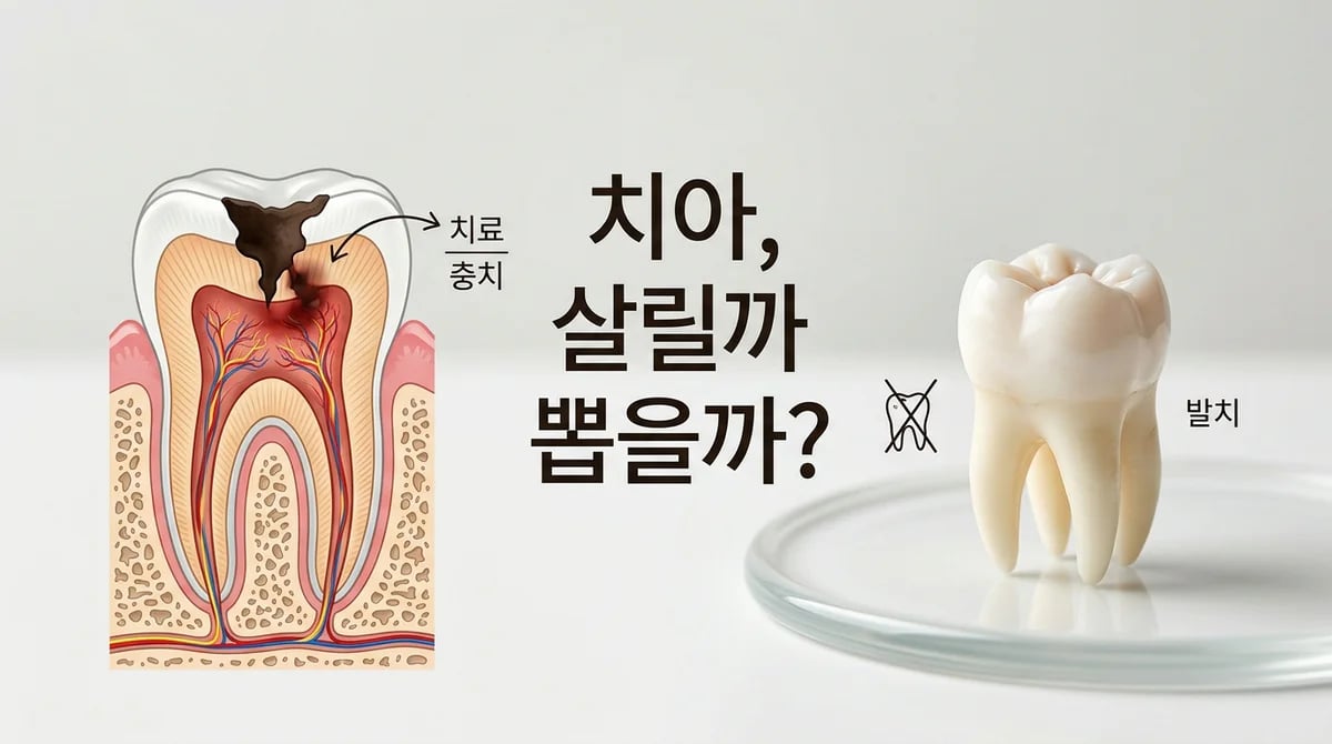 심한 충치, 신경치료 vs 발치? 수복 가능성으로 현명한 선택하기