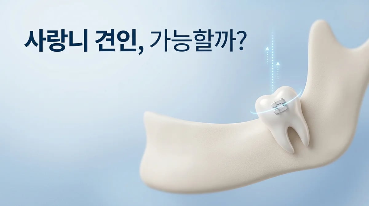 매복 사랑니 발치 대신 견인? 가능성, 조건 4가지, 현실적 한계 가이드