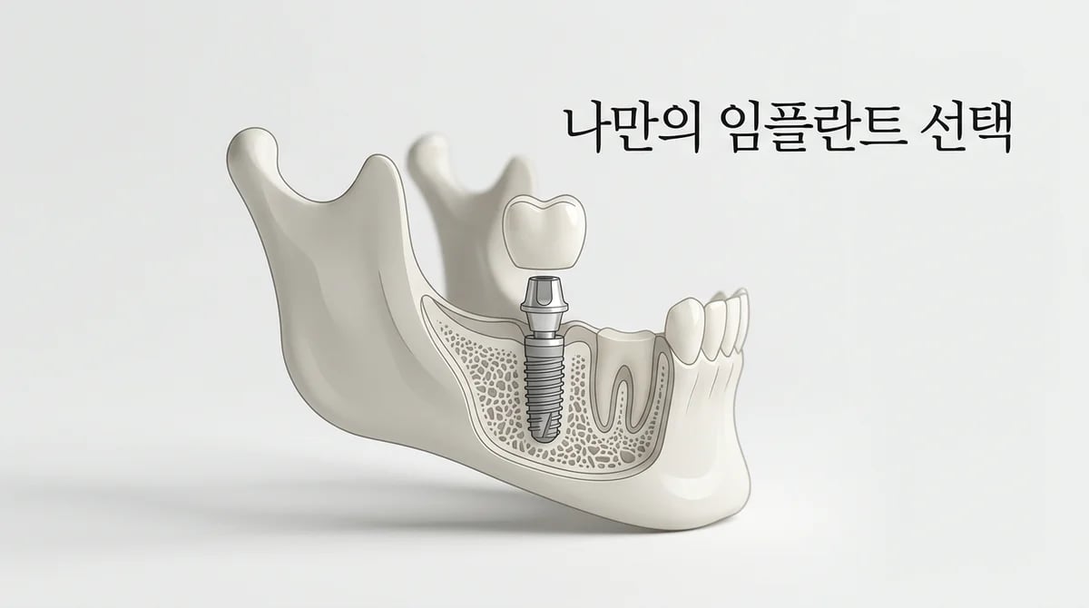 성공적인 임플란트 선택 가이드: 주요 구성 요소와 특징 분석