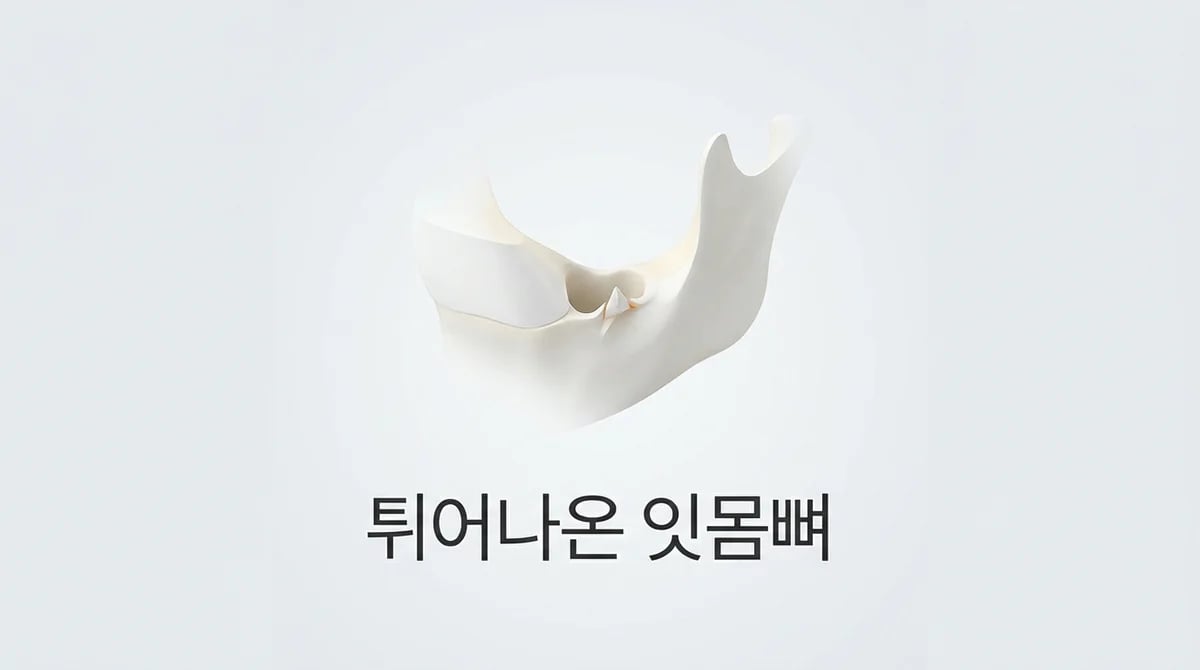 발치 후 잇몸 뼈 돌출: 왜 생기고, 어떻게 관리해야 할까요?