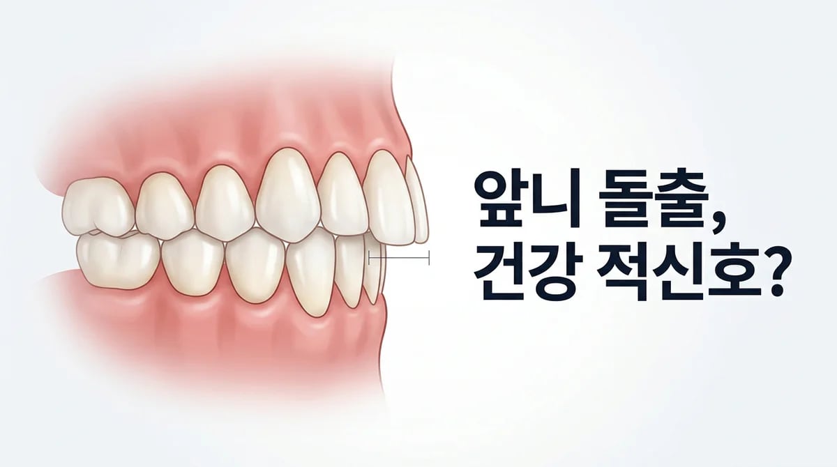 치아 오버젯, 앞니 돌출과 구강 건강: 원인 및 영향 4가지
