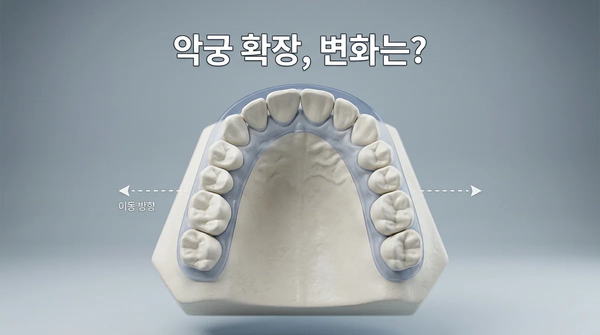 악궁확장술, 좁은 악궁 언제 필요할까? 성장기 아동과 성인 치료
