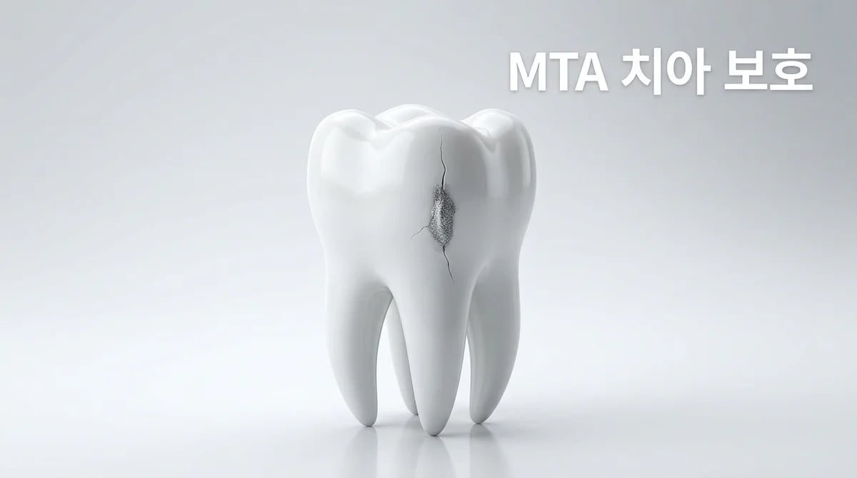 크랙 치아와 MTA 치료: 원리, 역할, 신중한 고려사항 3가지