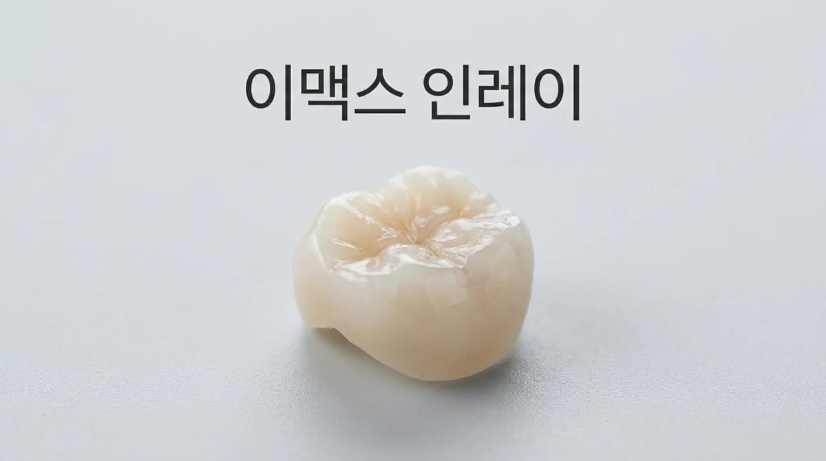이맥스 인레이: 리튬 디실리케이트 치과 보철의 장점과 고려사항