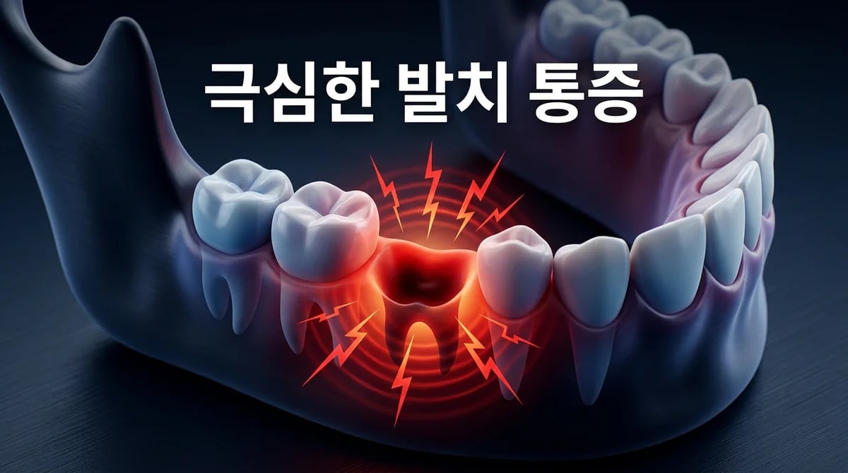 발치 후 극심한 통증: 건성 발치와(드라이 소켓) 증상과 관리법