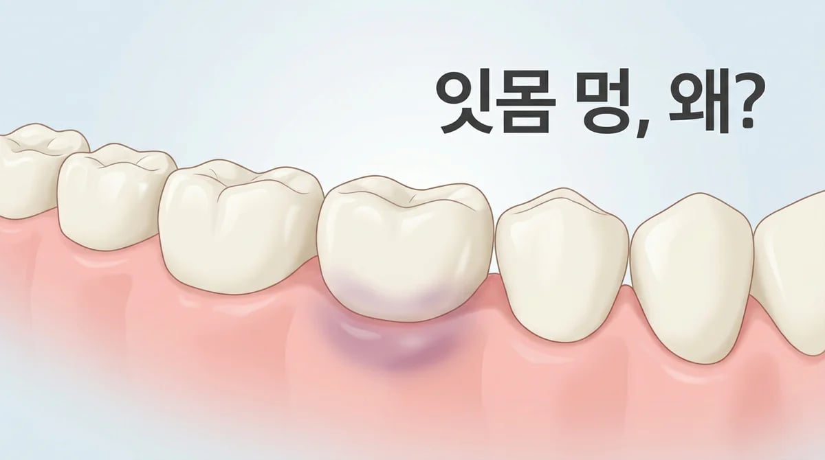 잇몸에 멍처럼 보일 때: 사라지지 않는 변색, 원인과 대처법