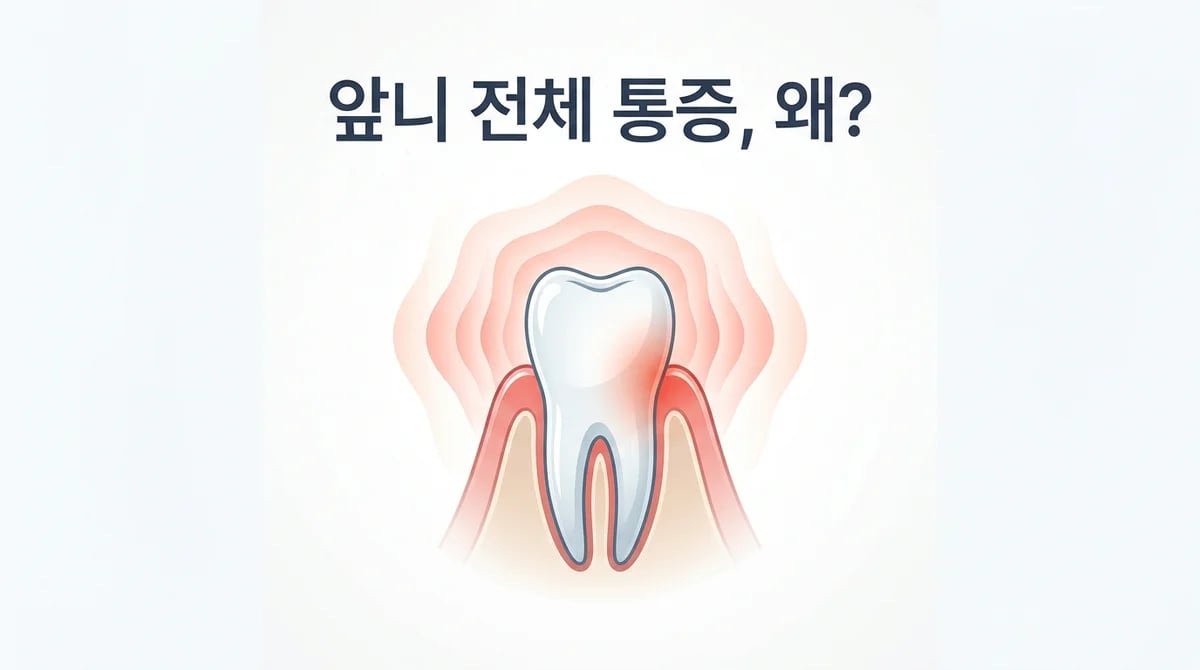 앞니 전체 통증? 충치 없는 통증의 4가지 주요 원인