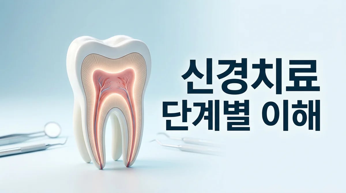 치과 신경치료 4단계 과정 상세 해설: 통증 완화와 자연치아 보존