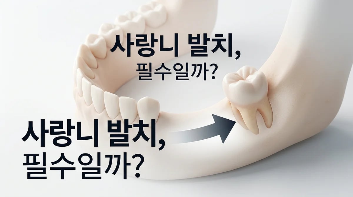 치아교정 전 사랑니 발치, 꼭 해야 할까요? 핵심 원칙 2가지