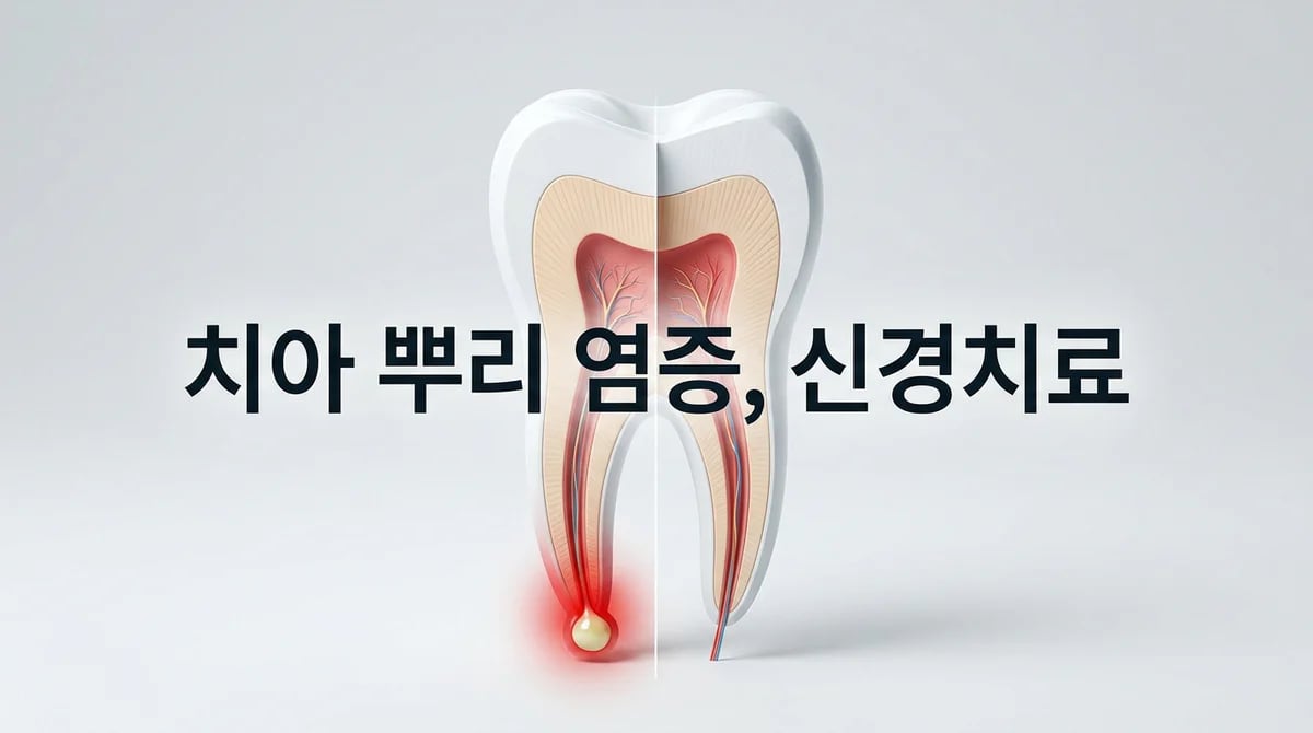 급성치근단치주염: 신경치료로 통증 관리 및 치아 보존 방법
