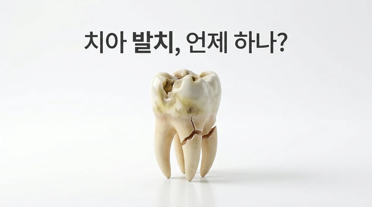 충치로 인한 치아 발치: 임상적 고려 사항과 보존 대안