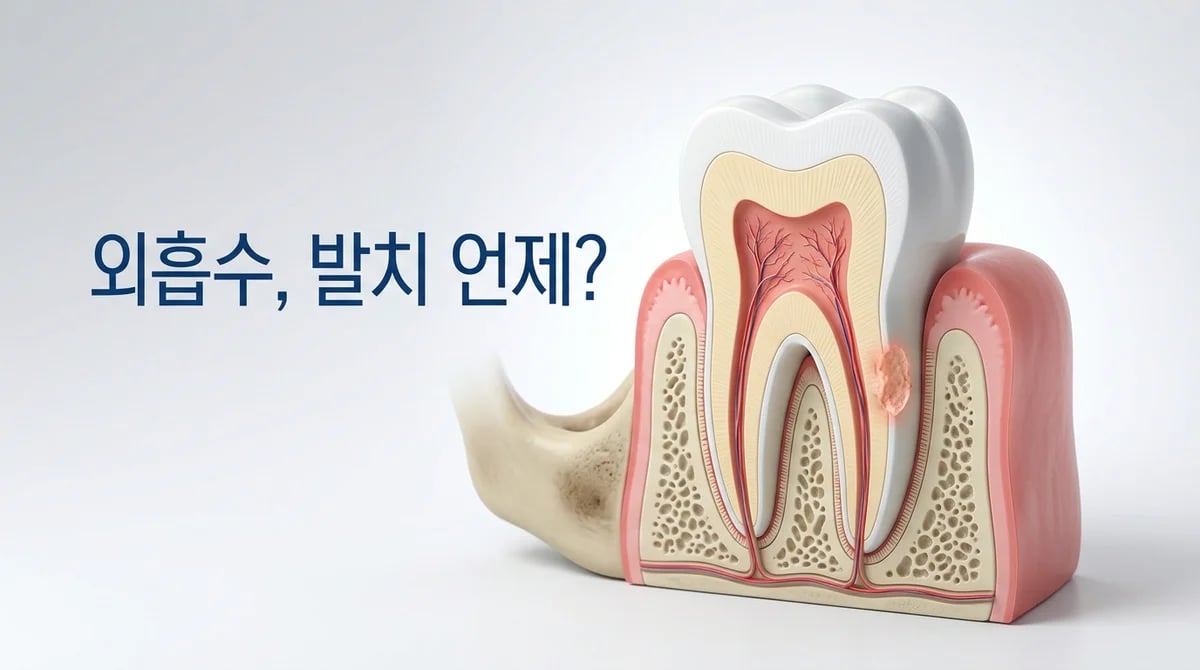 치아 외흡수 진단: 발치 결정은 언제, 4가지 핵심 기준