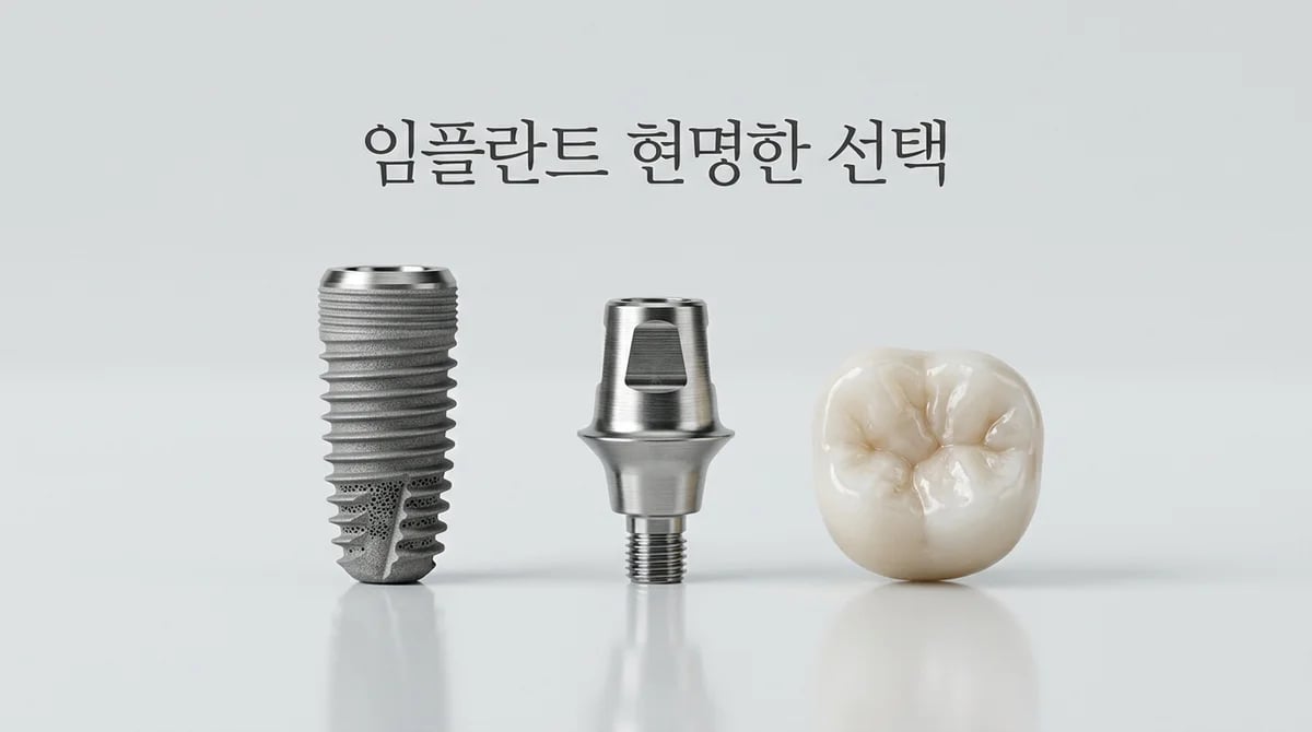 현명한 임플란트 선택 가이드: 재료와 시스템 완벽 이해