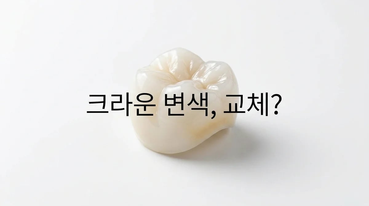 올세라믹 보철물 변색, 언제 교체를 고려해야 할까요? 4가지 진단 기준