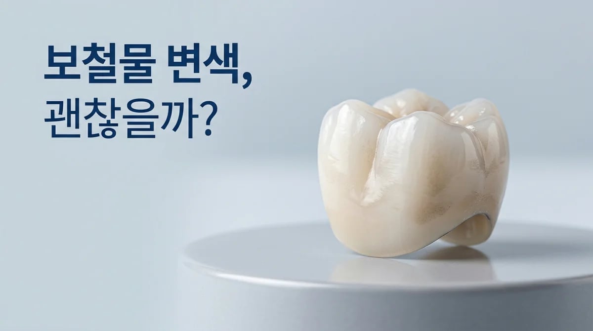 올세라믹 보철물 변색: 원인 분석과 교체 시기 판단 가이드