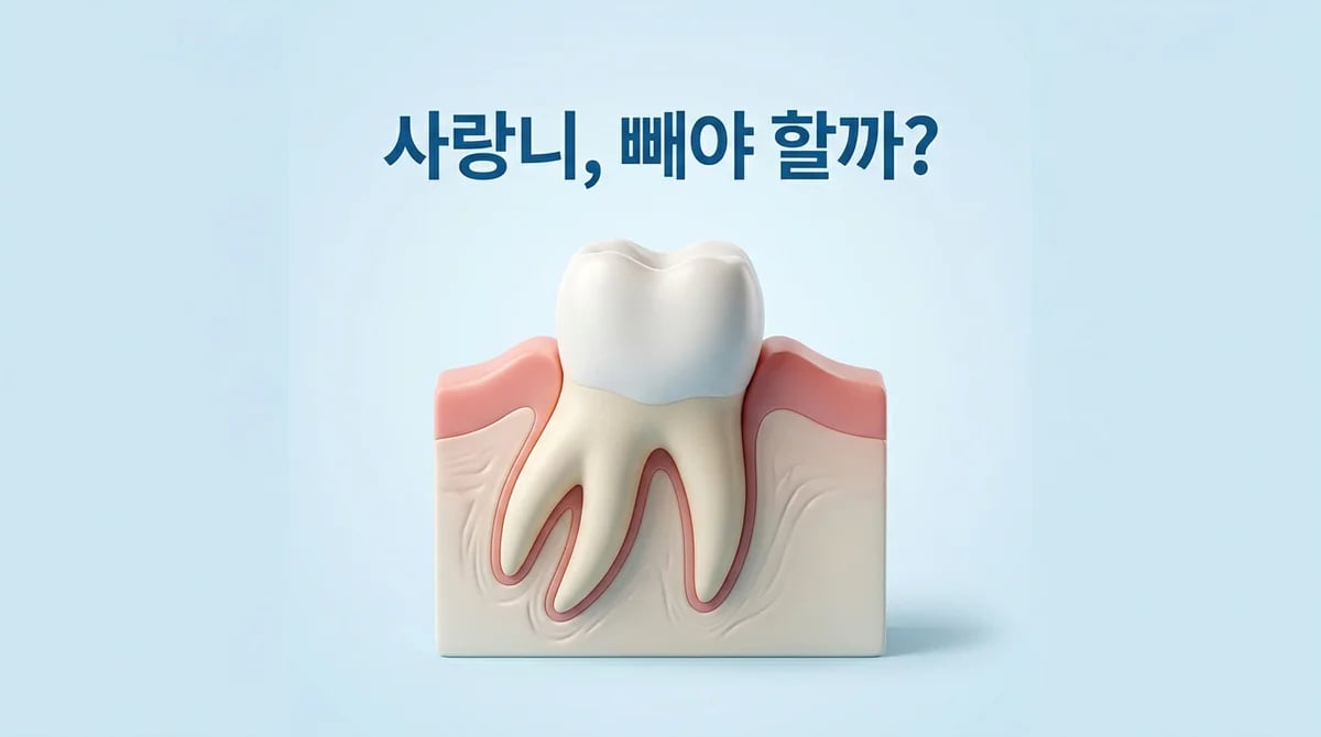 사랑니 발치, 꼭 필요할까요? 4가지 의학적 기준과 관리법