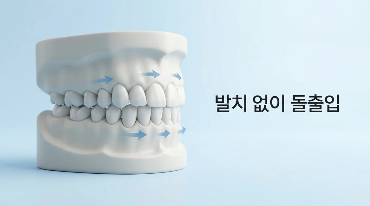 돌출입 비발치 교정, 언제 가능하며 어떤 효과를 기대할 수 있을까?