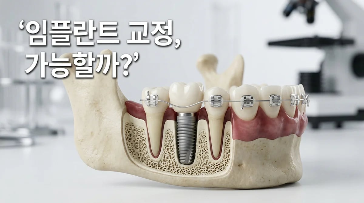 임플란트 있어도 치아 교정 가능할까? 전문가가 답하는 4가지 핵심 원칙