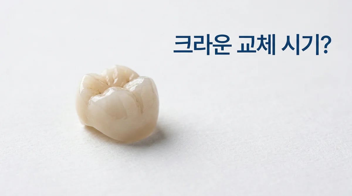치아 크라운 교체, 언제 해야 할까요? 6가지 신호와 수명 알아보기