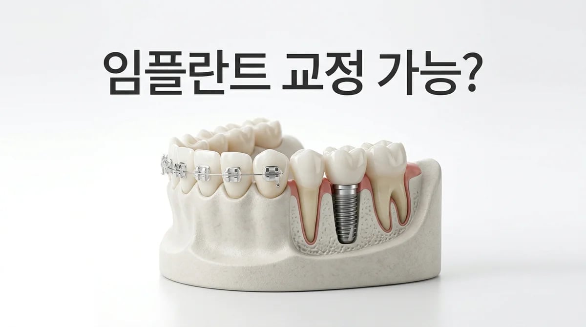 임플란트와 보철물, 치아교정 가능한가요? 성공적인 치료 전략 3가지