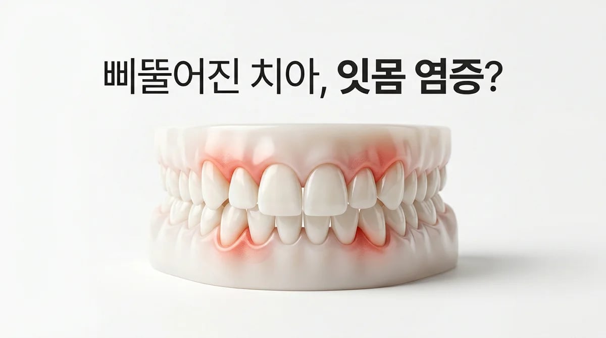 불균형한 치열과 잇몸 염증: 2가지 숨겨진 연관성 및 과학적 관리법
