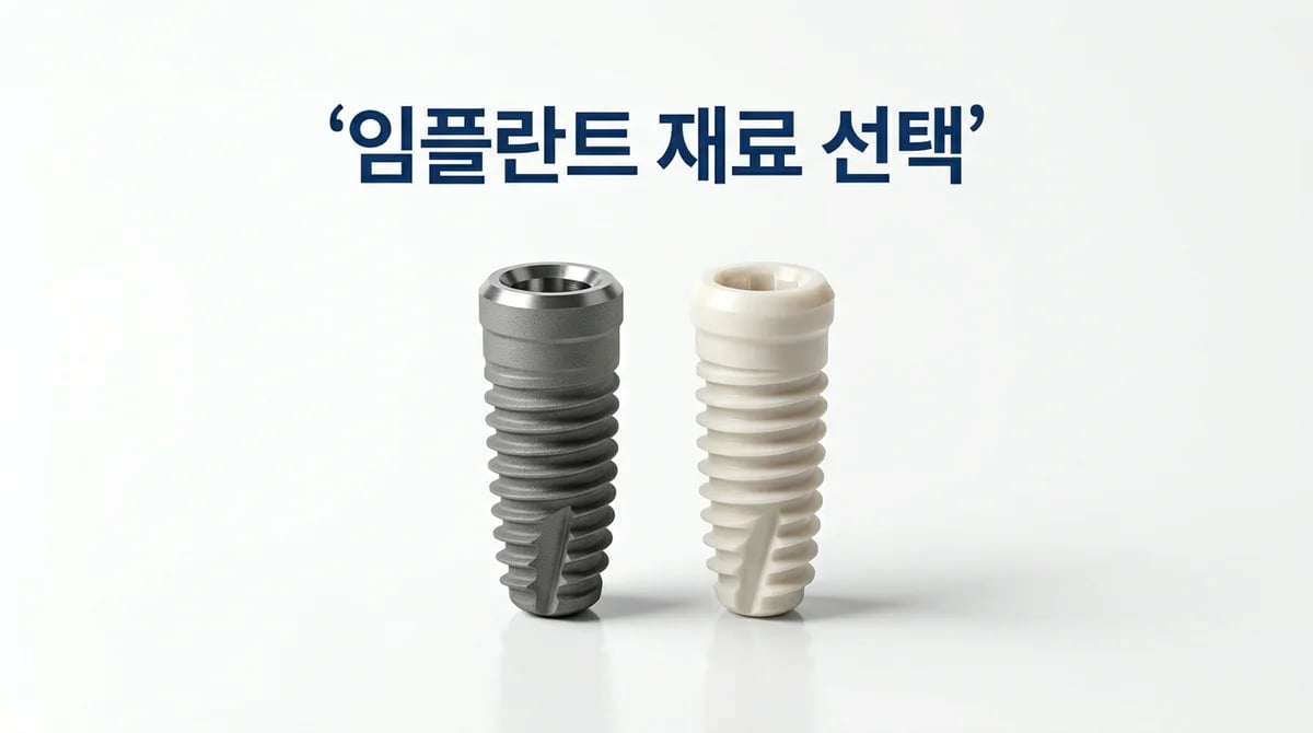 임플란트 재료의 과학: 안정적인 골유착을 위한 핵심 기술 원리