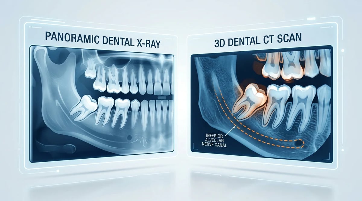 치과 파노라마 X-ray와 3D CT 이미지를 통해 사랑니와 주변 어금니를 진단하는 모습