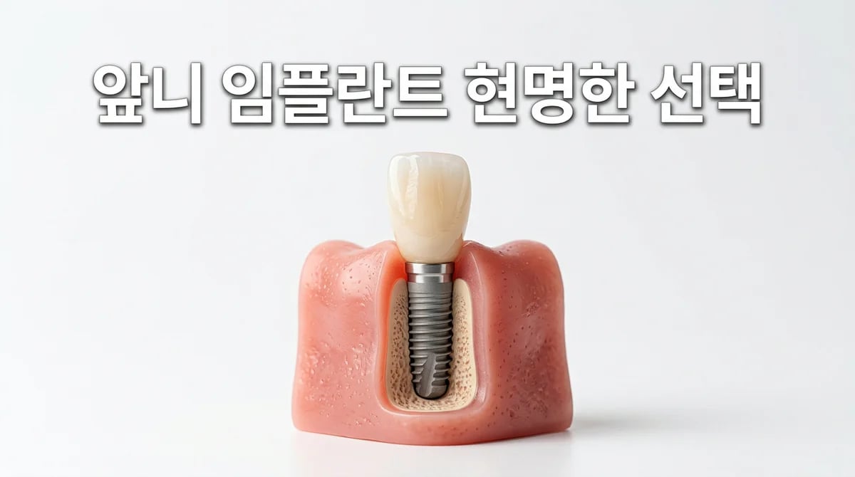 앞니 임플란트 비용과 심미성: 뼈이식·잇몸이식 고려사항