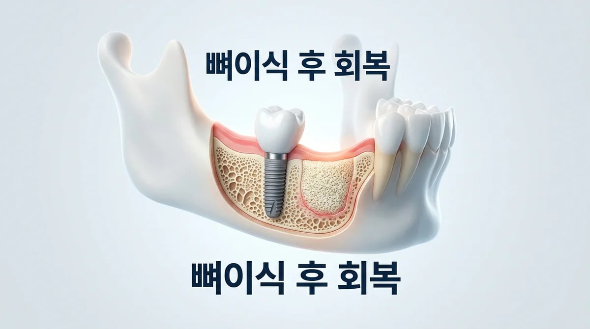 치과 뼈이식 후 부기와 피멍, 올바른 대처법 및 관리 가이드
