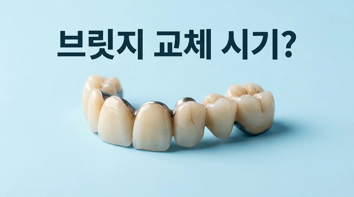 오래된 치아 브릿지, 언제 교체해야 할까? 5가지 위험 신호와 고려사항