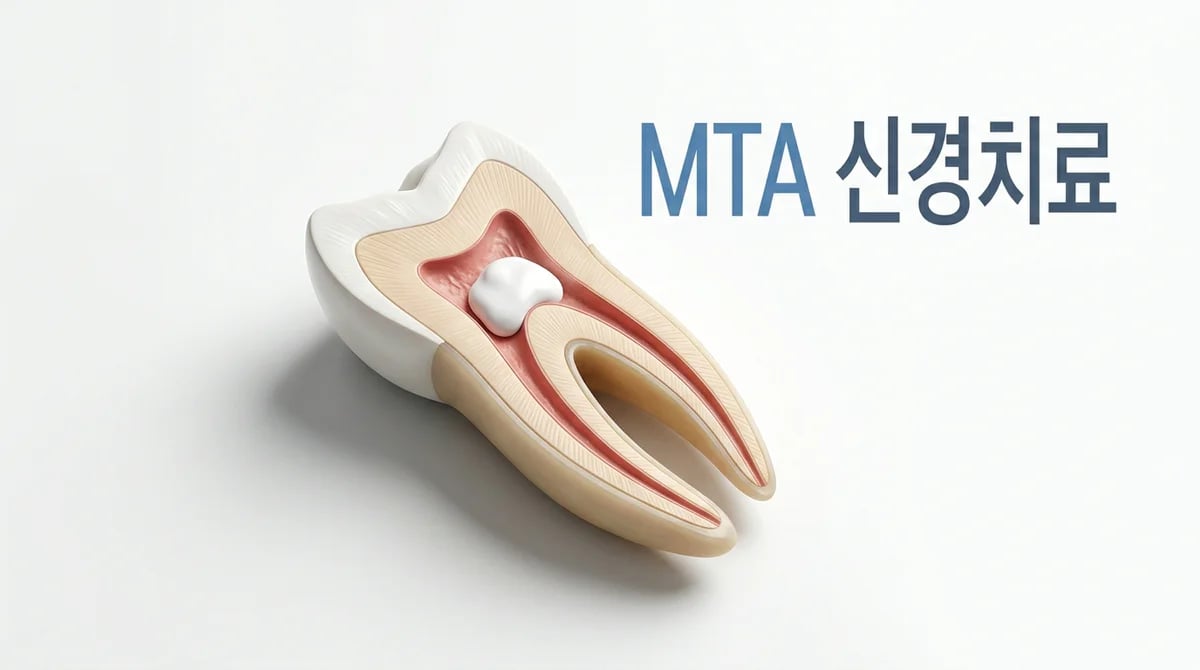 미성숙 영구치 MTA 신경치료: 뿌리 성장을 돕는 치아 보존적 접근