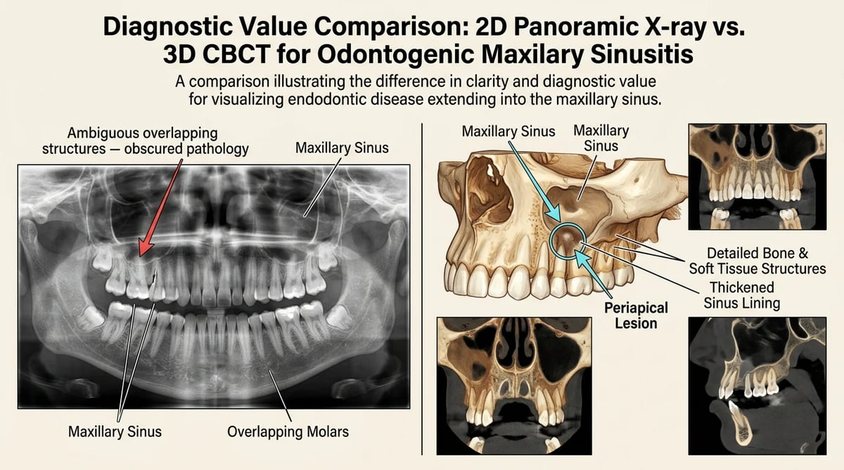 2D X-ray와 3D 치과 CT(CBCT) 영상 비교를 통해 치아 뿌리 염증과 상악동의 관계를 보여주는 이미지